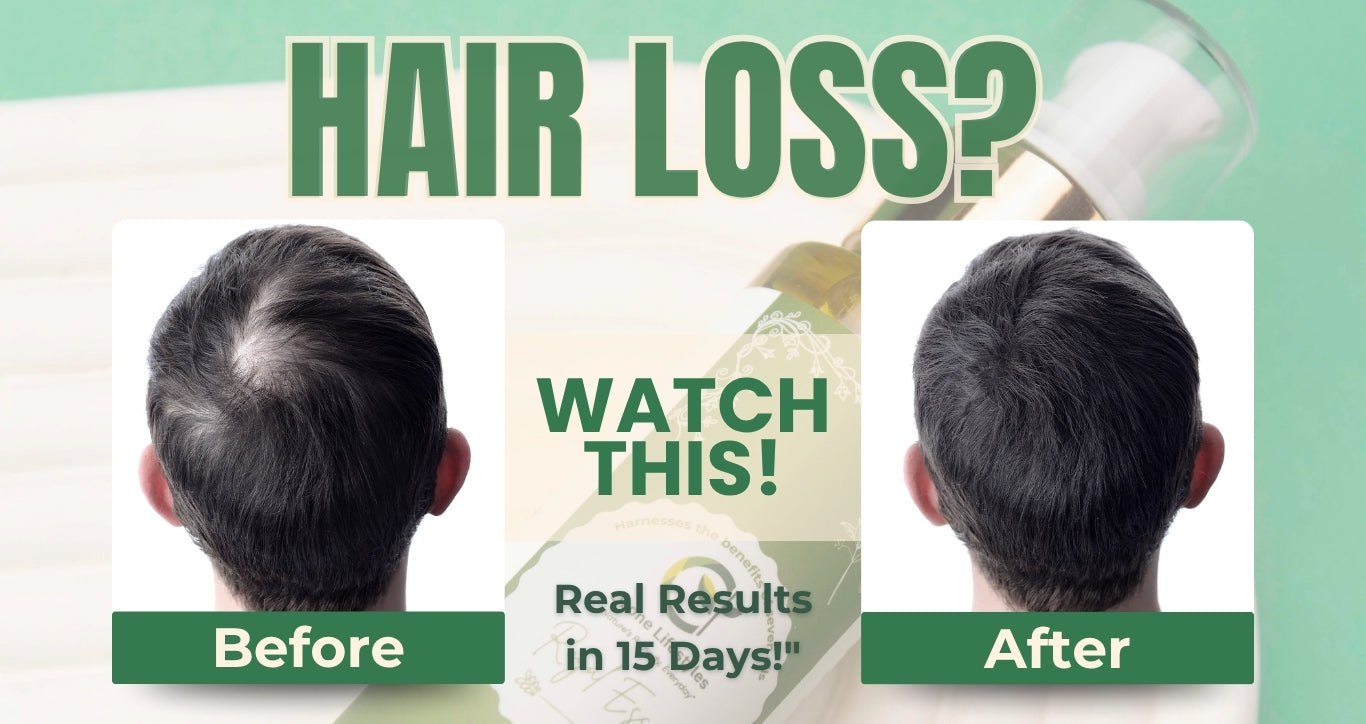 Advertisement showing a before and after comparison of hair loss treatment with text 'Hair Loss? Watch this! Real Results in 15 Days!'.