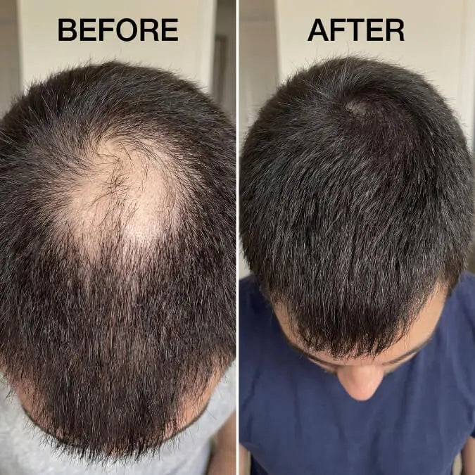 Royal Essence Hair Oil