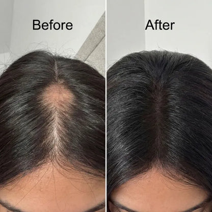 Royal Essence Hair Oil